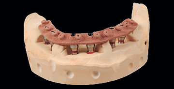 Piliers et barres usinées CAD/CAM